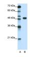 Transcription Factor AP-2 Alpha antibody, orb333121, Biorbyt, Western Blot image 