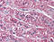 Somatostatin receptor type 5 antibody, TA317369, Origene, Immunohistochemistry paraffin image 