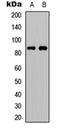 Fibroblast Growth Factor Receptor Substrate 2 antibody, orb256541, Biorbyt, Western Blot image 