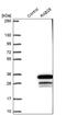 RAB28, Member RAS Oncogene Family antibody, PA5-60759, Invitrogen Antibodies, Western Blot image 