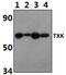 TXK Tyrosine Kinase antibody, PA5-75953, Invitrogen Antibodies, Western Blot image 