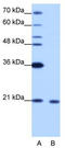 RNA-binding protein 8A antibody, TA345911, Origene, Western Blot image 