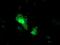 Mitochondrial import receptor subunit TOM34 antibody, MA5-25623, Invitrogen Antibodies, Immunocytochemistry image 