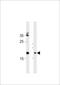 Shisa Like 2A antibody, A31951, Boster Biological Technology, Western Blot image 