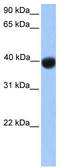 Single Stranded DNA Binding Protein 4 antibody, TA345449, Origene, Western Blot image 