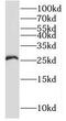 RING finger protein 170 antibody, FNab07346, FineTest, Western Blot image 