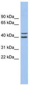 F-Box And Leucine Rich Repeat Protein 14 antibody, TA338847, Origene, Western Blot image 
