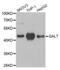Galactose-1-Phosphate Uridylyltransferase antibody, abx004808, Abbexa, Western Blot image 