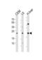 Phosphatidylethanolamine N-Methyltransferase antibody, LS-C163519, Lifespan Biosciences, Western Blot image 