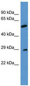 Calcium-binding protein 4 antibody, TA342744, Origene, Western Blot image 