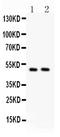 c-Myc antibody, LS-C312722, Lifespan Biosciences, Western Blot image 