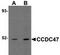 Coiled-Coil Domain Containing 47 antibody, TA306883, Origene, Western Blot image 