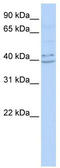 Pyrin And HIN Domain Family Member 1 antibody, TA339837, Origene, Western Blot image 