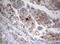 Serine/Threonine Kinase 11 antibody, M00217-2, Boster Biological Technology, Immunohistochemistry paraffin image 