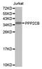 Protein Phosphatase 2 Catalytic Subunit Beta antibody, A07661, Boster Biological Technology, Western Blot image 