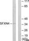 Sideroflexin 4 antibody, TA316038, Origene, Western Blot image 