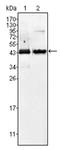 Alpha-Methylacyl-CoA Racemase antibody, AM06190SU-N, Origene, Western Blot image 