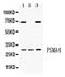 Proteasome subunit alpha type-4 antibody, PA5-79891, Invitrogen Antibodies, Western Blot image 