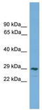 C-Type Lectin Domain Family 4 Member M antibody, TA329529, Origene, Western Blot image 