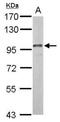 Dyn3 antibody, NBP2-42836, Novus Biologicals, Western Blot image 