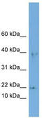 Actin Related Protein 2/3 Complex Subunit 3 antibody, TA340069, Origene, Western Blot image 