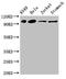 Iron Responsive Element Binding Protein 2 antibody, LS-C678371, Lifespan Biosciences, Western Blot image 