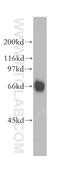 RB Binding Protein 5, Histone Lysine Methyltransferase Complex Subunit antibody, 13181-1-AP, Proteintech Group, Western Blot image 