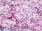 STEAP2 Metalloreductase antibody, LS-B5085, Lifespan Biosciences, Immunohistochemistry paraffin image 