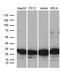 Ribosomal Protein L10a antibody, MA5-27171, Invitrogen Antibodies, Western Blot image 