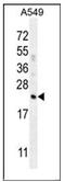 Complement Factor D antibody, AP50877PU-N, Origene, Western Blot image 