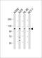 Collagen Type XVII Alpha 1 Chain antibody, 63-780, ProSci, Western Blot image 