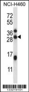 Methyltransferase Like 23 antibody, 57-059, ProSci, Western Blot image 
