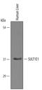 Sulfotransferase Family 1E Member 1 antibody, AF5545, R&D Systems, Western Blot image 