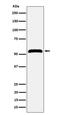 Membrane Palmitoylated Protein 1 antibody, M05793, Boster Biological Technology, Western Blot image 