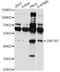 Zinc Finger Protein 597 antibody, A15681, Boster Biological Technology, Western Blot image 
