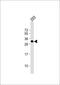 TGFB Induced Factor Homeobox 2 antibody, 58-005, ProSci, Western Blot image 