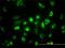 Acetyl-CoA Acyltransferase 2 antibody, H00010449-M01, Novus Biologicals, Immunofluorescence image 