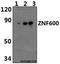 Zinc Finger Protein 600 antibody, GTX66805, GeneTex, Western Blot image 