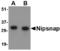 Protein NipSnap homolog 1 antibody, TA306549, Origene, Western Blot image 