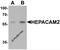 HEPACAM Family Member 2 antibody, 7111, ProSci, Western Blot image 