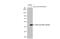 Zika Virus antibody, GTX634159, GeneTex, Western Blot image 