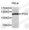 Importin 4 antibody, A8746, ABclonal Technology, Western Blot image 