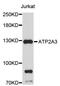 ATPase Sarcoplasmic/Endoplasmic Reticulum Ca2+ Transporting 3 antibody, STJ22719, St John