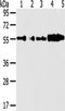 Cytochrome P450 Family 7 Subfamily A Member 1 antibody, TA351400, Origene, Western Blot image 