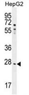 Nuclear Receptor Subfamily 0 Group B Member 2 antibody, AP52928PU-N, Origene, Western Blot image 