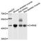 Cholinergic Receptor Nicotinic Epsilon Subunit antibody, STJ112097, St John