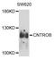 Centrobin, Centriole Duplication And Spindle Assembly Protein antibody, STJ110576, St John