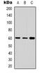 Cytochrome P450 Family 24 Subfamily A Member 1 antibody, LS-C368862, Lifespan Biosciences, Western Blot image 