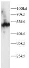 Keratin 7 antibody, FNab10415, FineTest, Western Blot image 