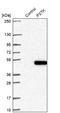 Phosphoseryl-TRNA Kinase antibody, NBP1-88541, Novus Biologicals, Western Blot image 